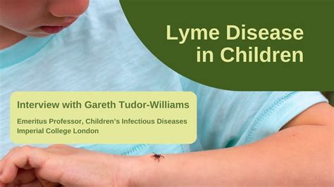 Lyme Disease in Children: Interview with Professor Gareth Tudor 